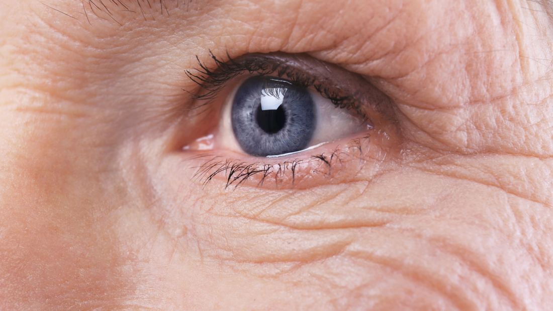 botox xeomin antiwrinkle dysport wrinkles